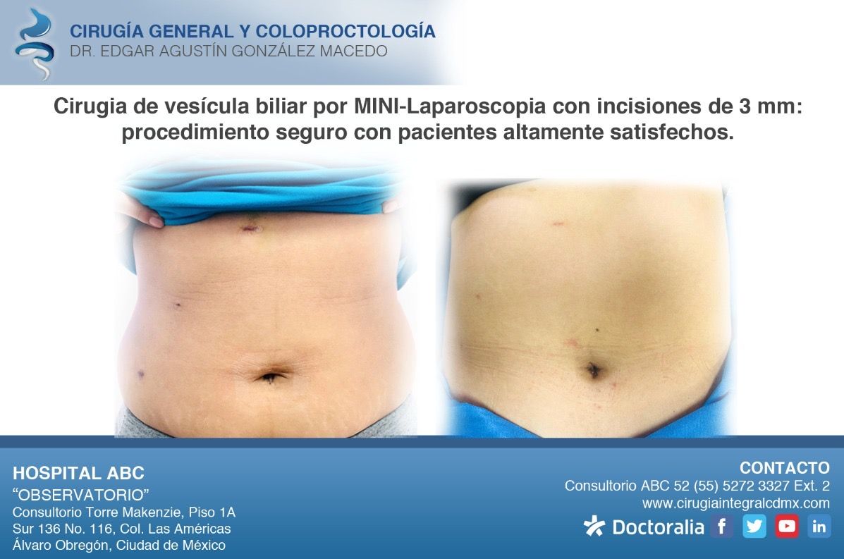 Edgar Agustín González Macedo-14