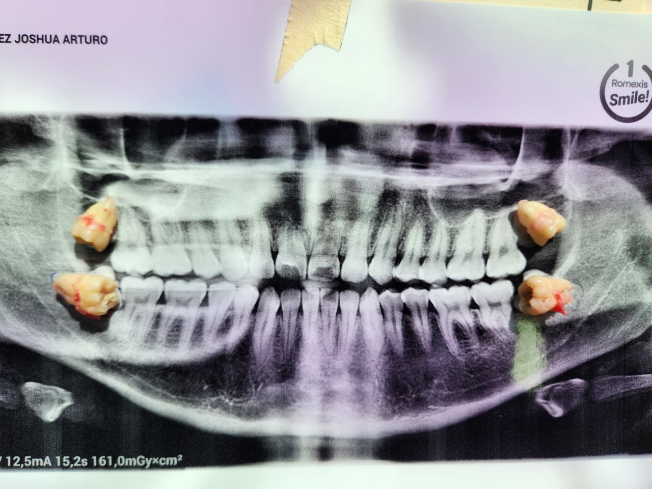 Fernando Olivier Victoriano-0