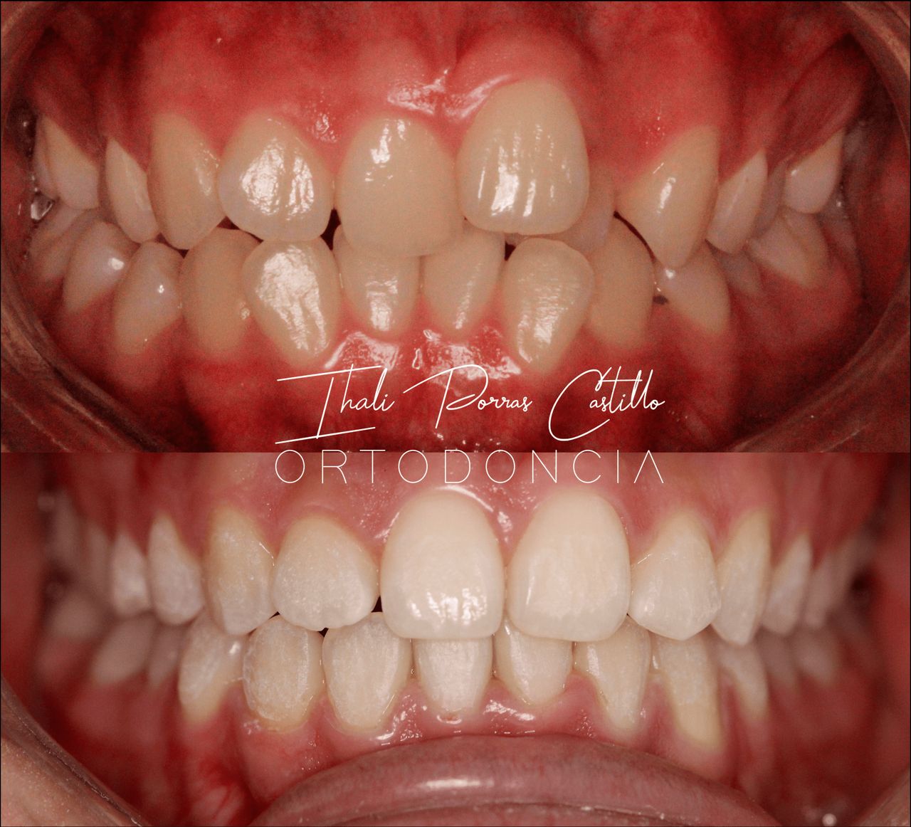 Ihali Porras Castillo-10