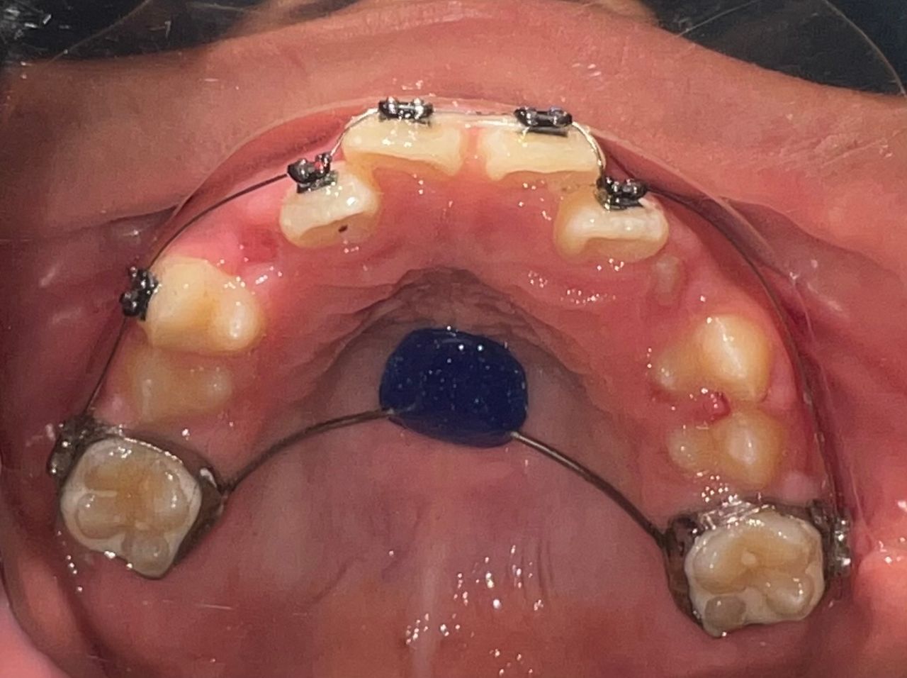 Gloria Haydee Castillo Castellanos-6