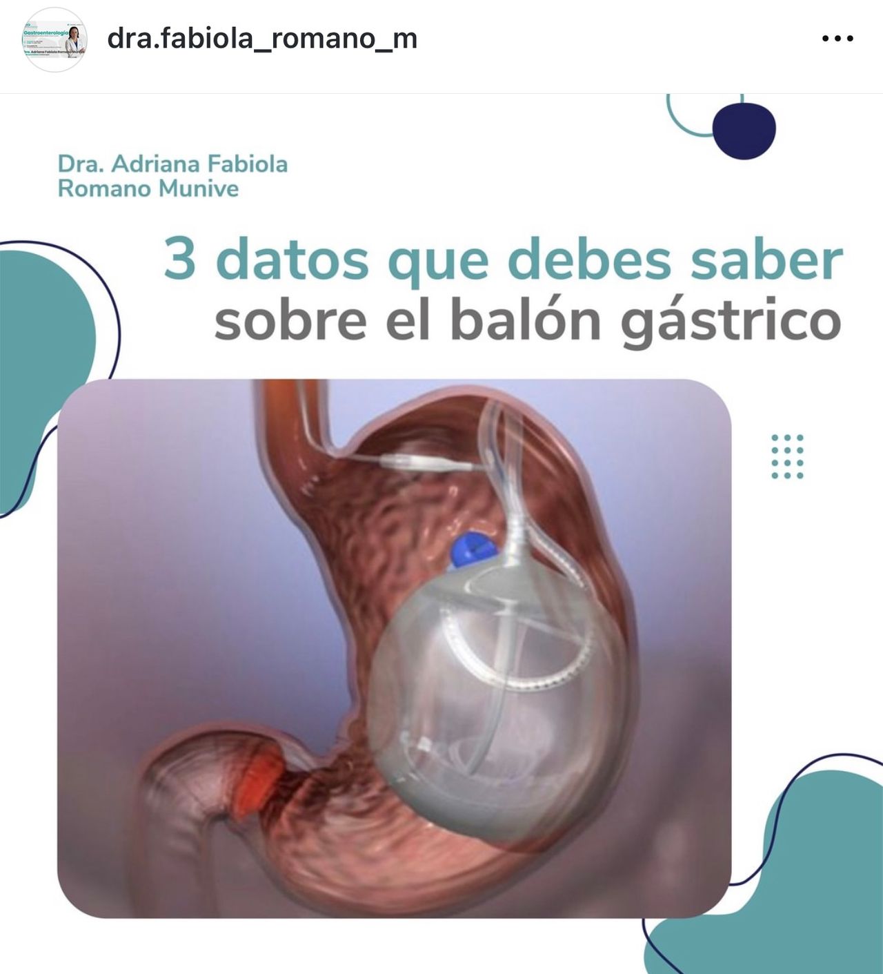 Adriana Fabiola Romano Munive-5