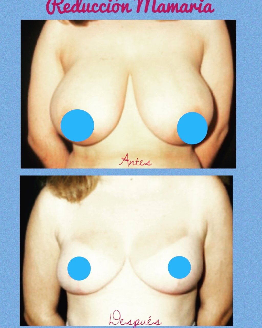 Carlos Lom García-0