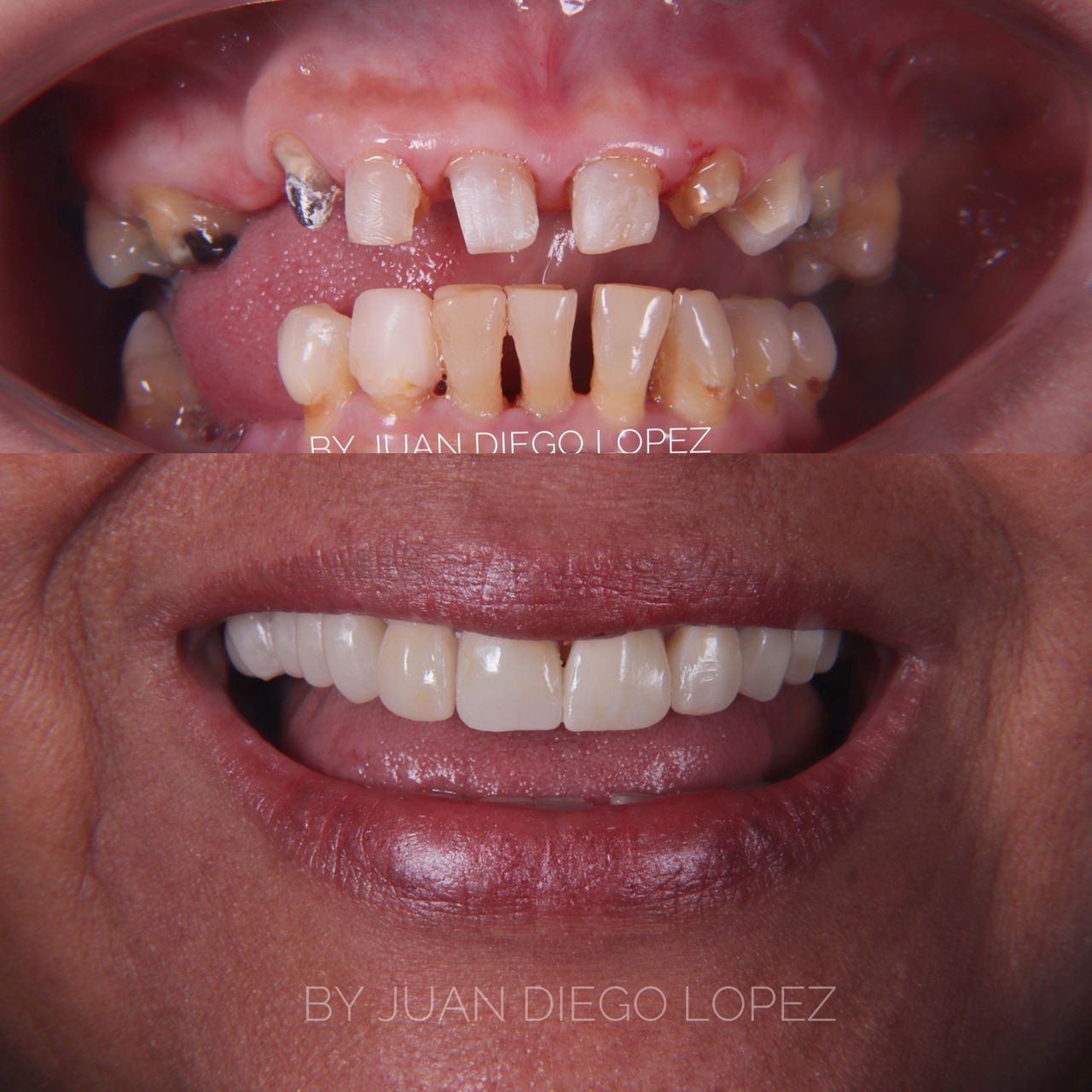 Juan Diego Lopez Ramirez-11