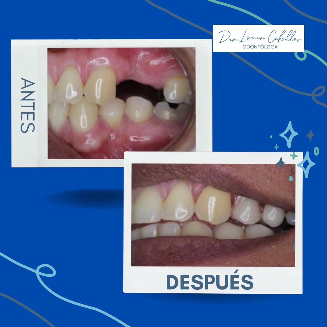 Laura Ceballos Brito-6