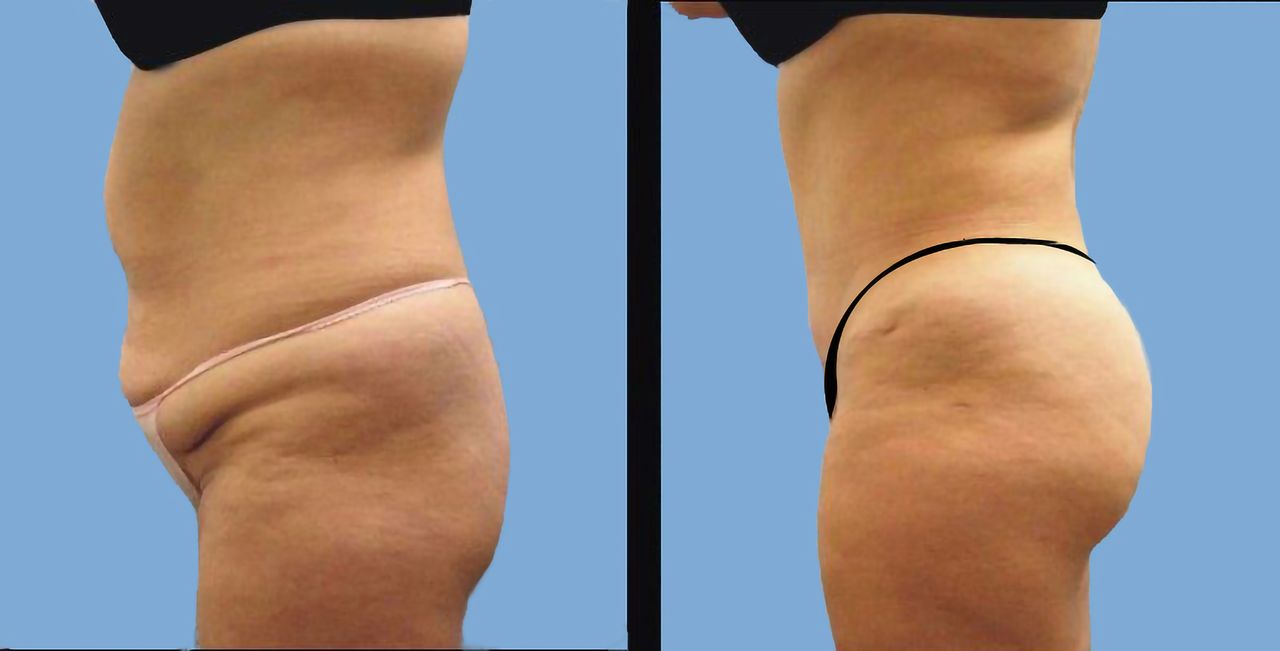 Ruby Lizardo Ramírez Robles-16