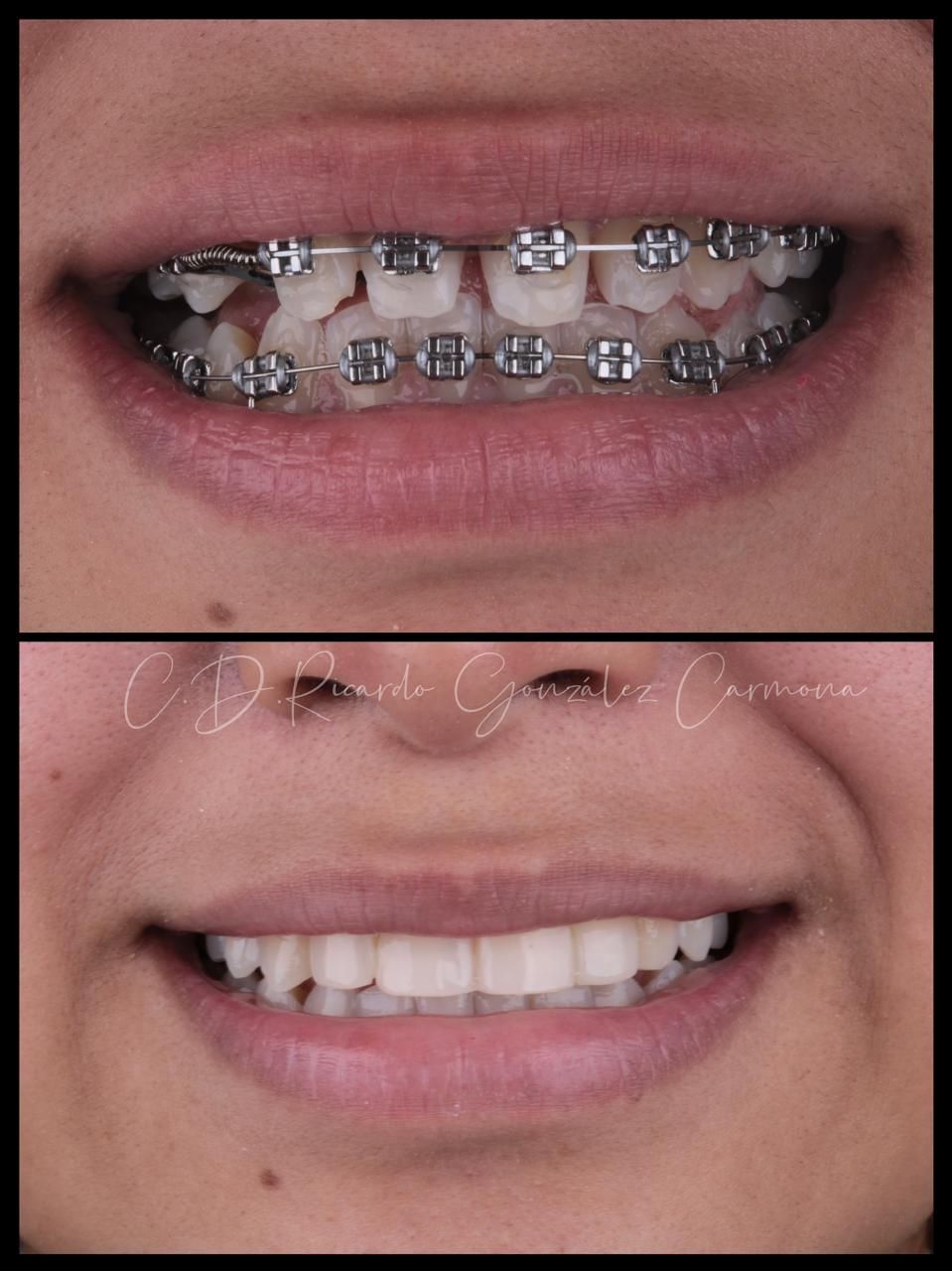 Alicia Carmona López-12