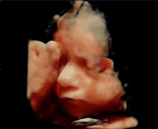 Miguel Angel González Nazar-12