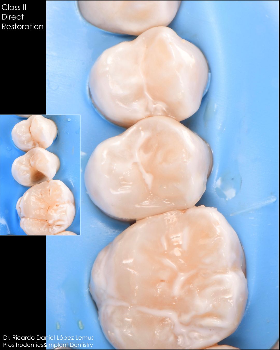 Ricardo López Lemus-44