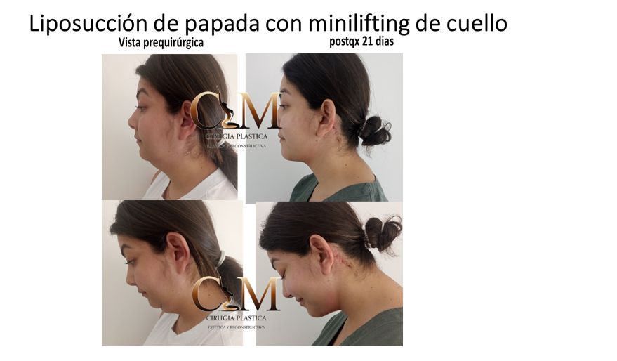 María Del Carmen Montilla Muñoz-7