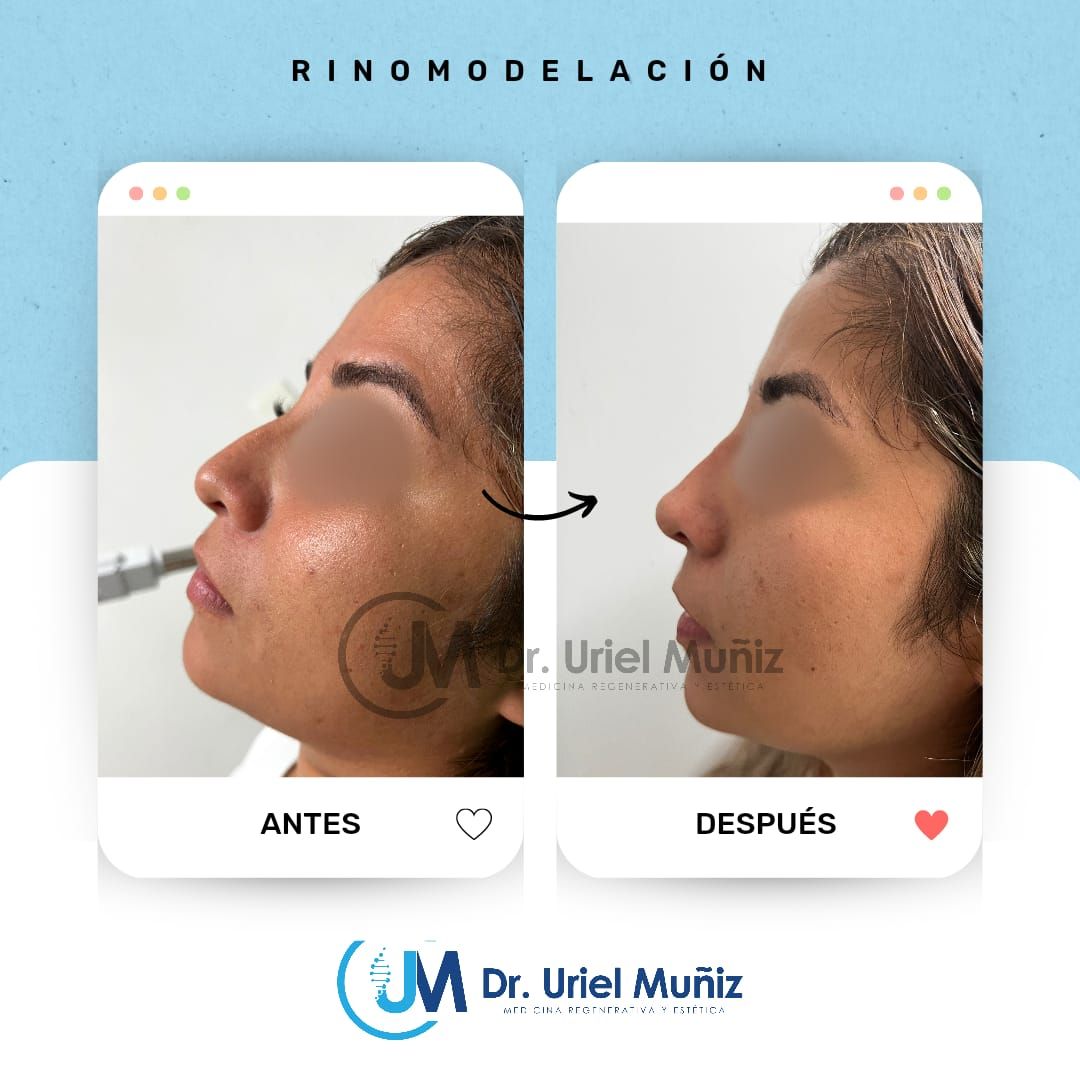 Teófilo Uriel Muñiz Chávez-41