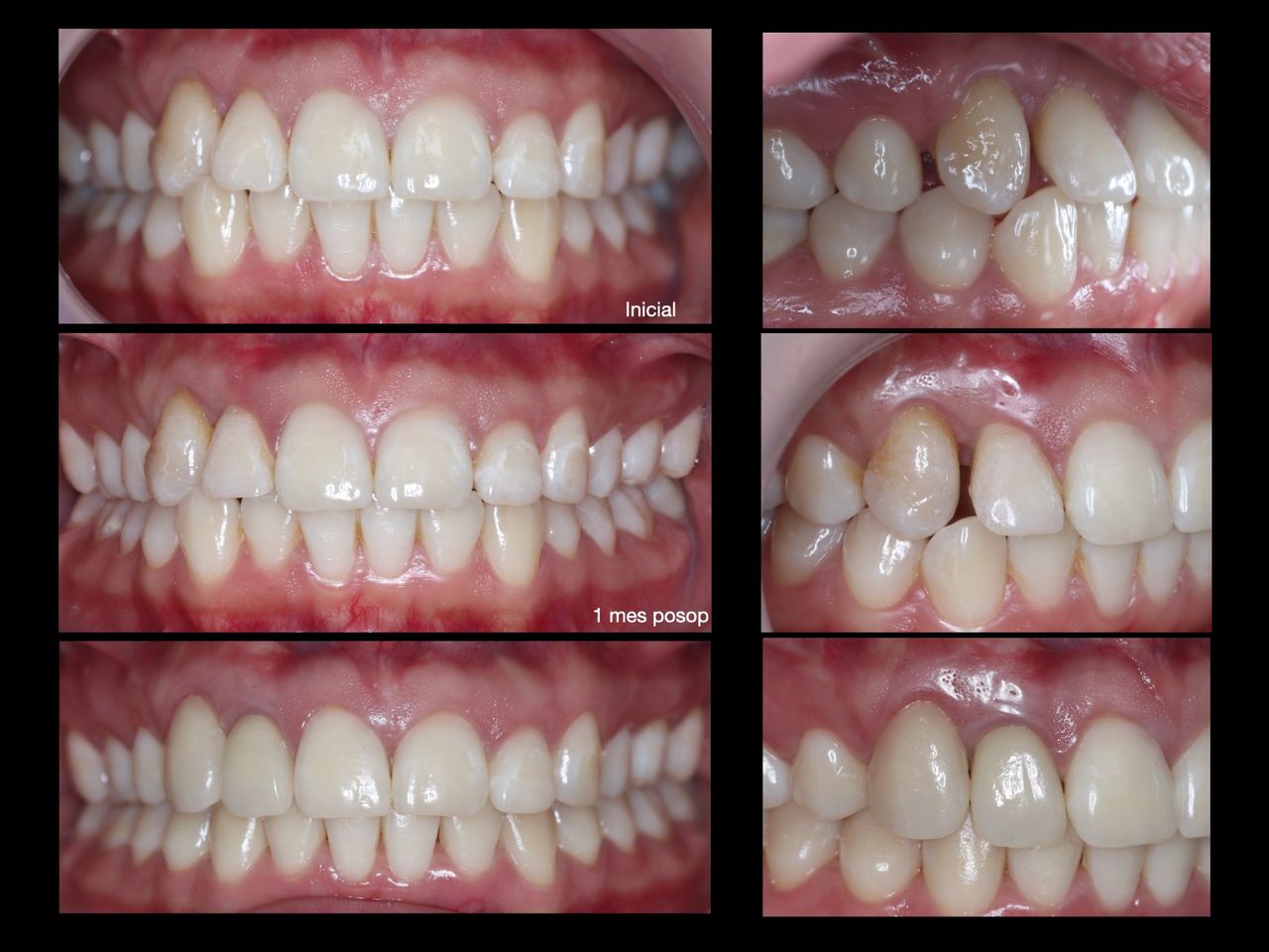 Yazmín Martínez -0