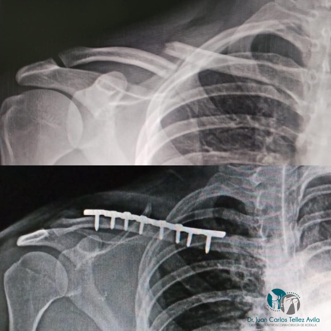 Juan Carlos Tellez Avila-6