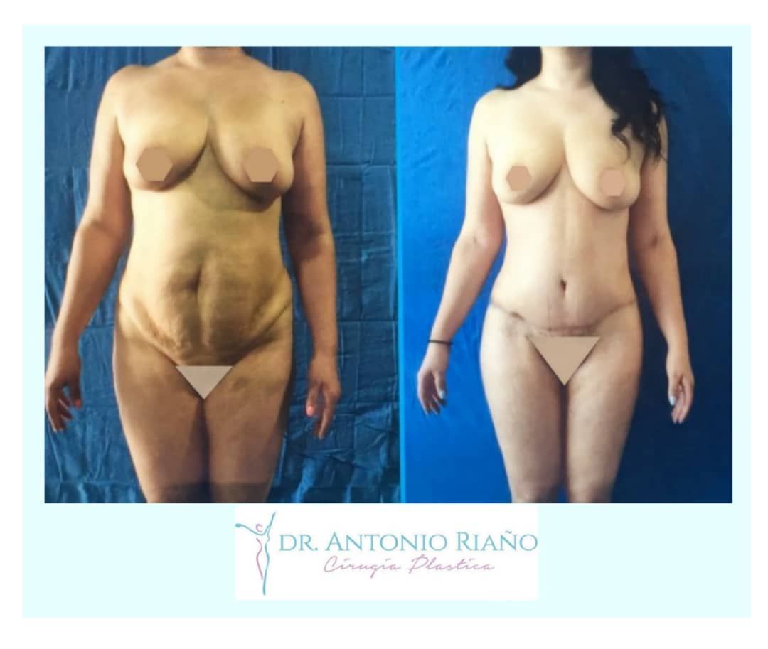 Jesús Antonio Riaño Rodríguez-6