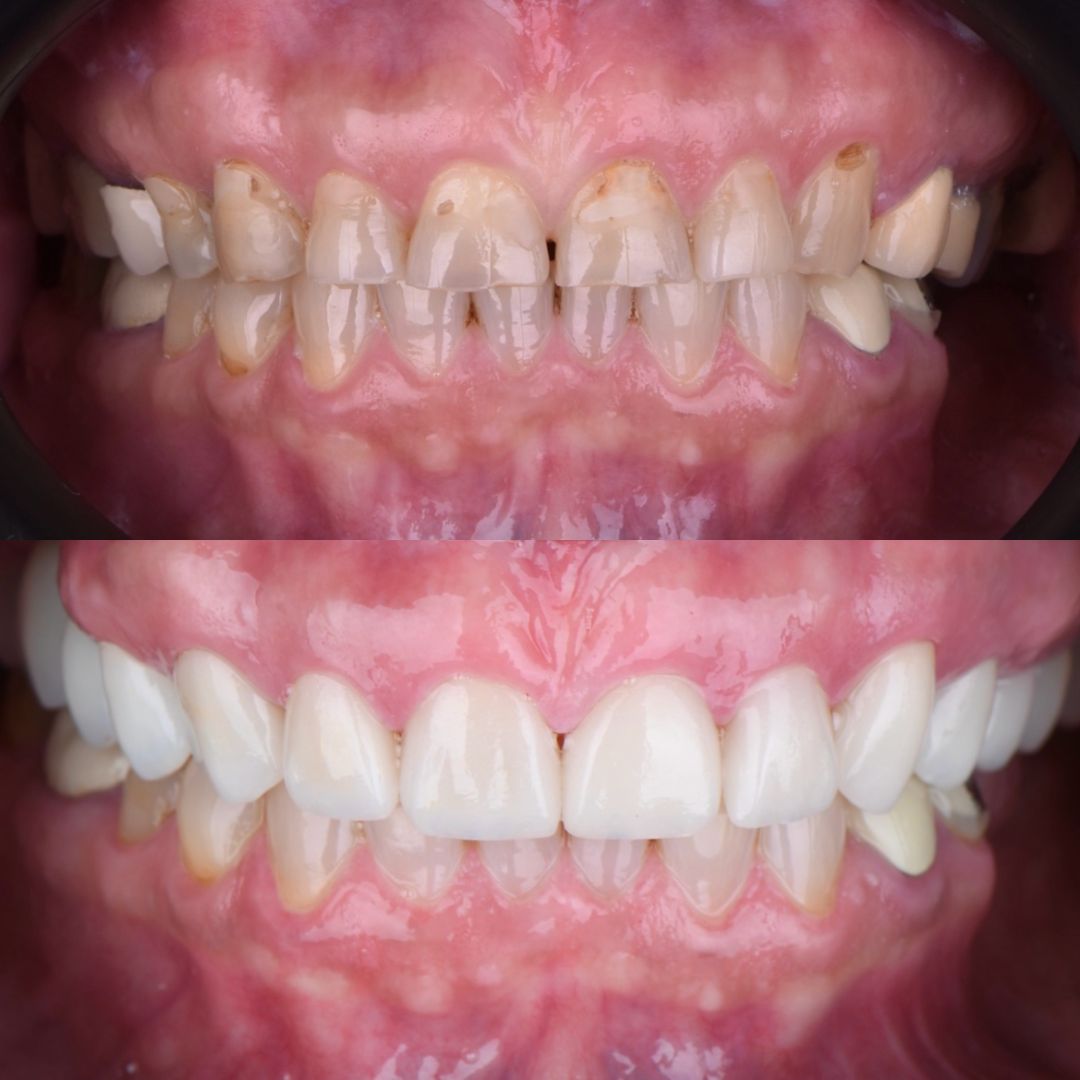 Irving Quezada Lara-10