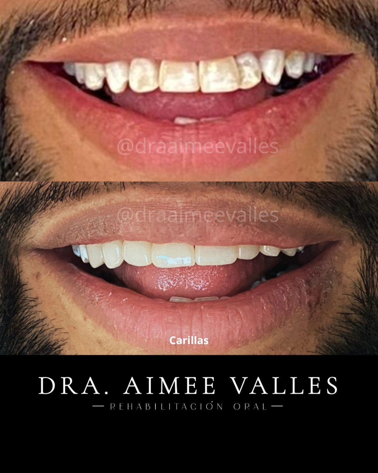 Aimee Valles Monárrez-50