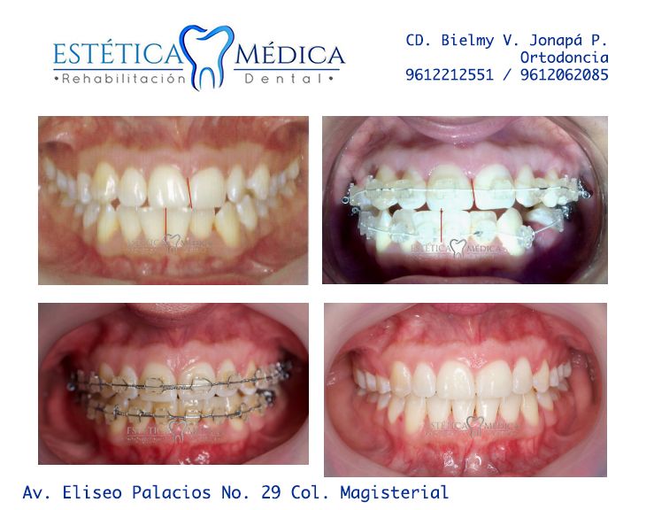 Bielmy Veronica Jonapa Peña-35