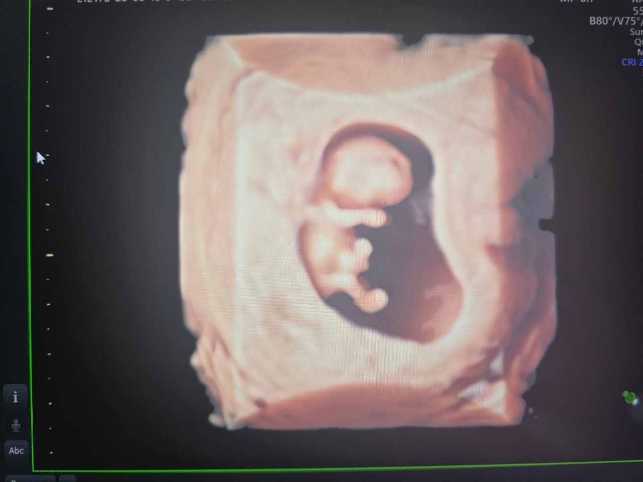 Abraham Ignacio Pérez De La Rosa-10