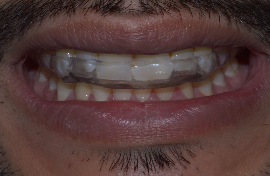 María Fernanda González Gastelum-71