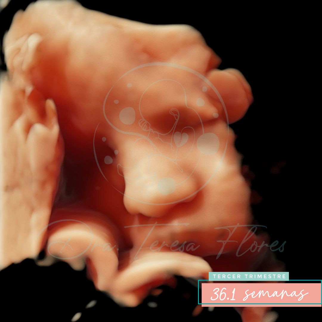 Teresa Miriam Flores Amador-3