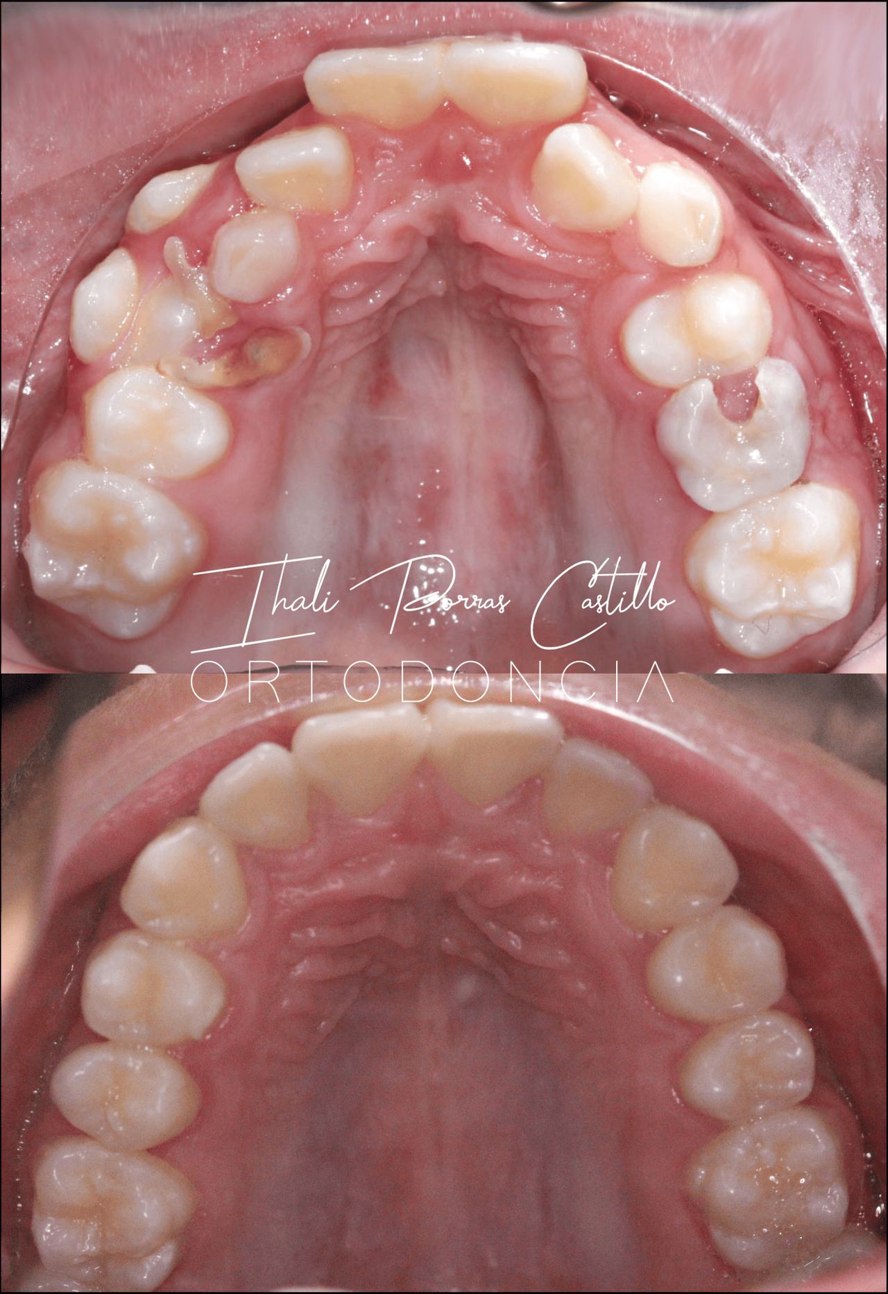 Ihali Porras Castillo-2