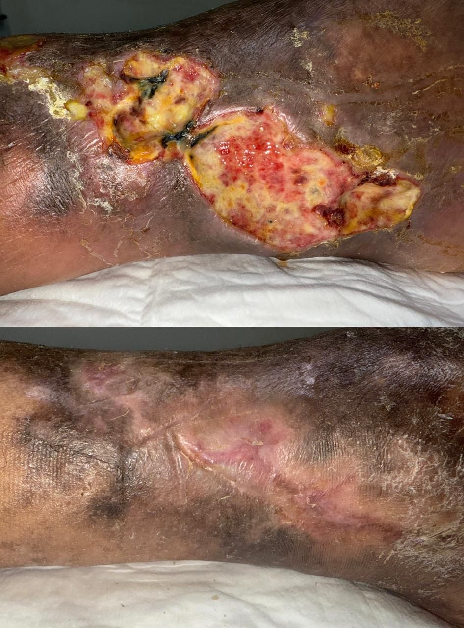 Jhonatan López González-5