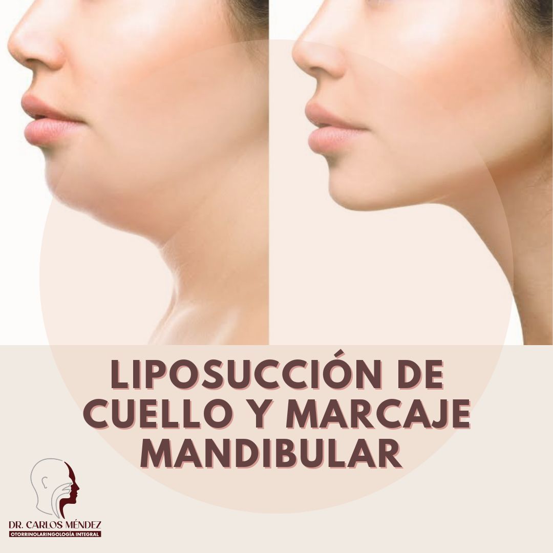 Juan Carlos Mendez Gutierrez-40