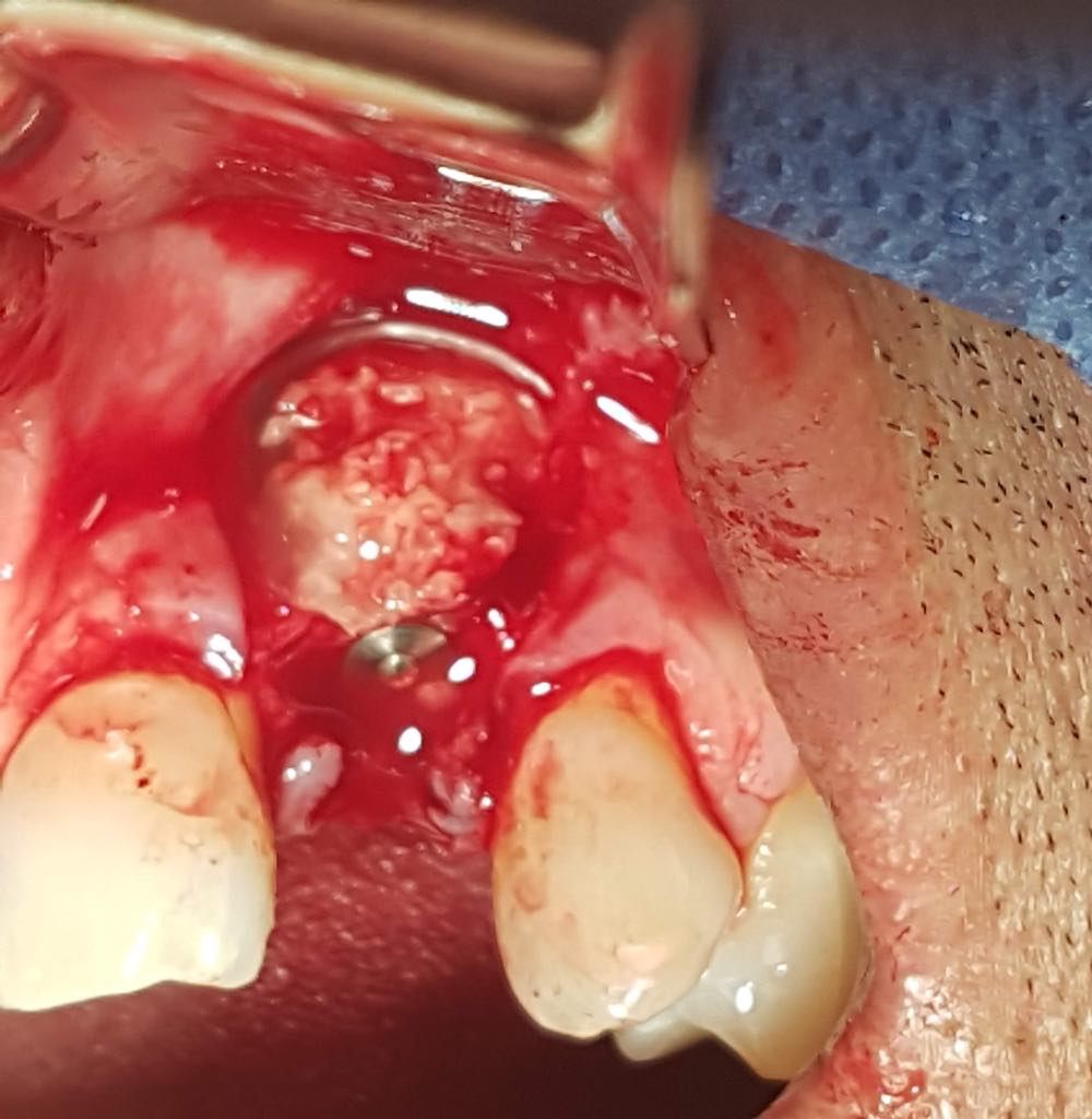 Zeyda Oliman Hoyos-4