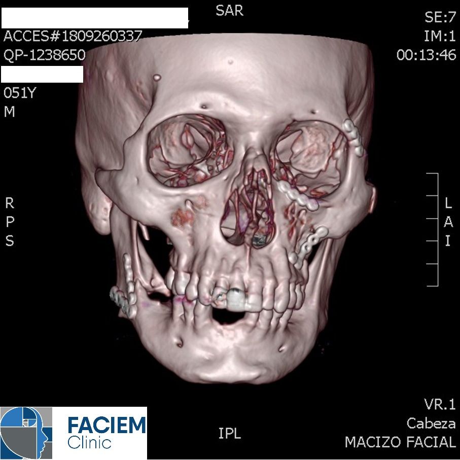 Arlen Colín Ordaz-40