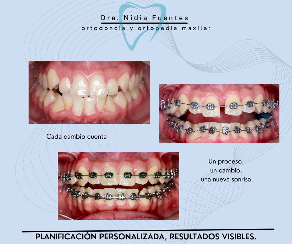 Nidia  Fuentes Aguilar-2