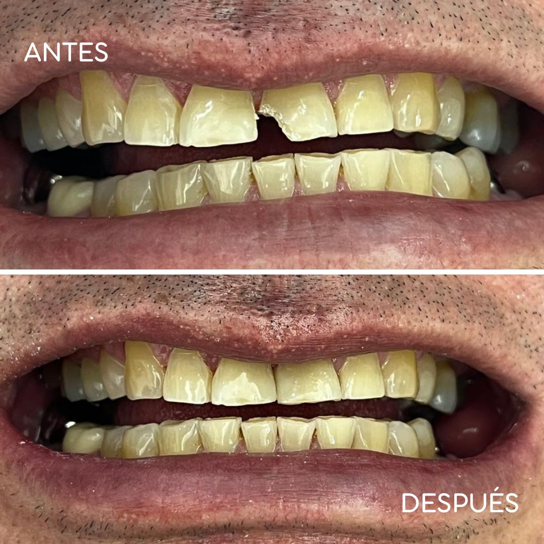 Consuelo Chapa Garza-3