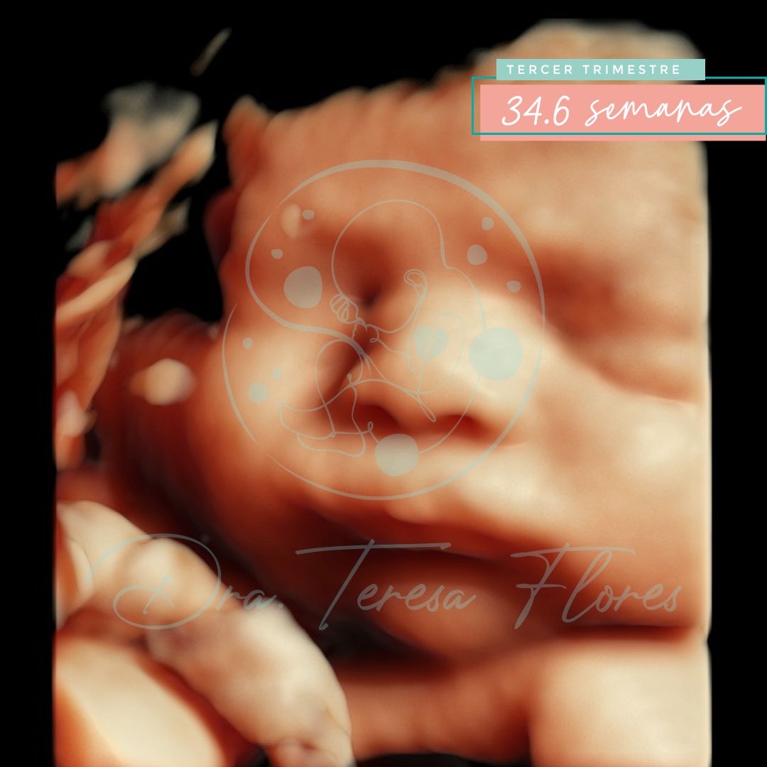 Teresa Miriam Flores Amador-0