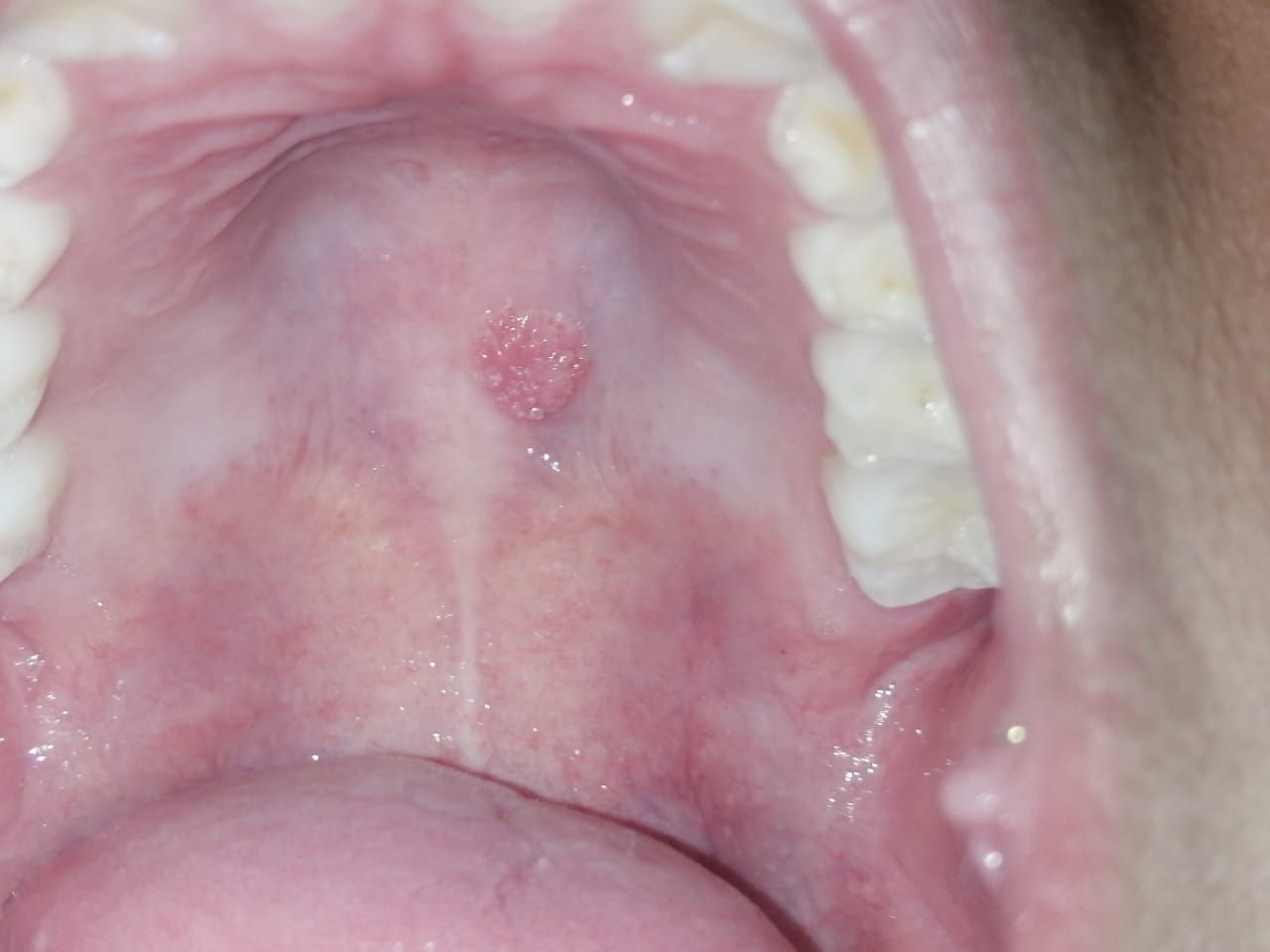 María Teresa Gómez Serrano-3