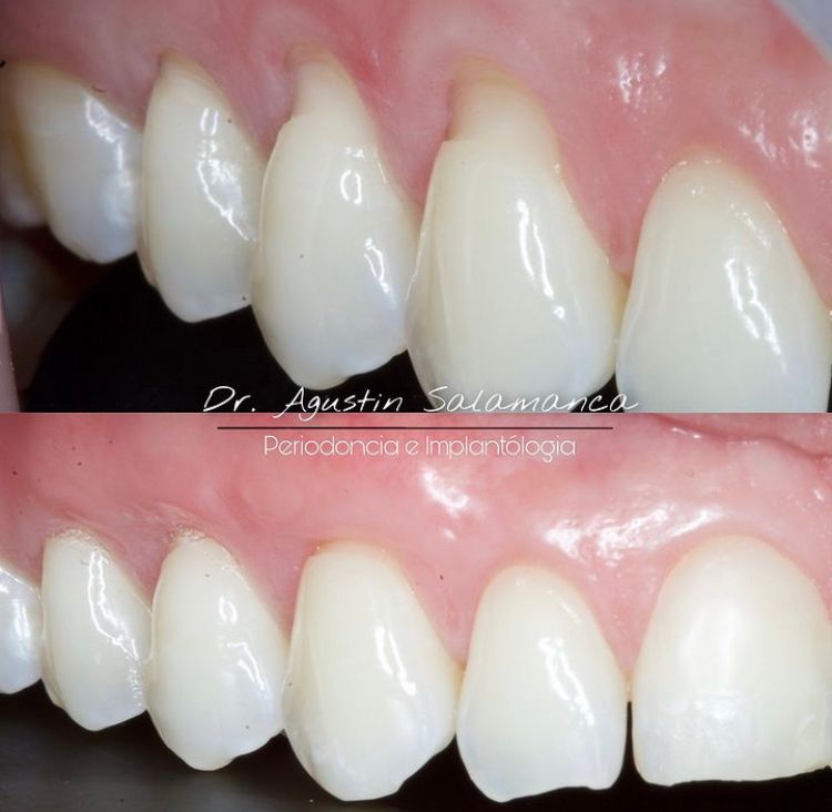 Agustin Salamanca Tapia-13