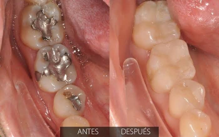 María De Jesús Albuerne Núñez-0