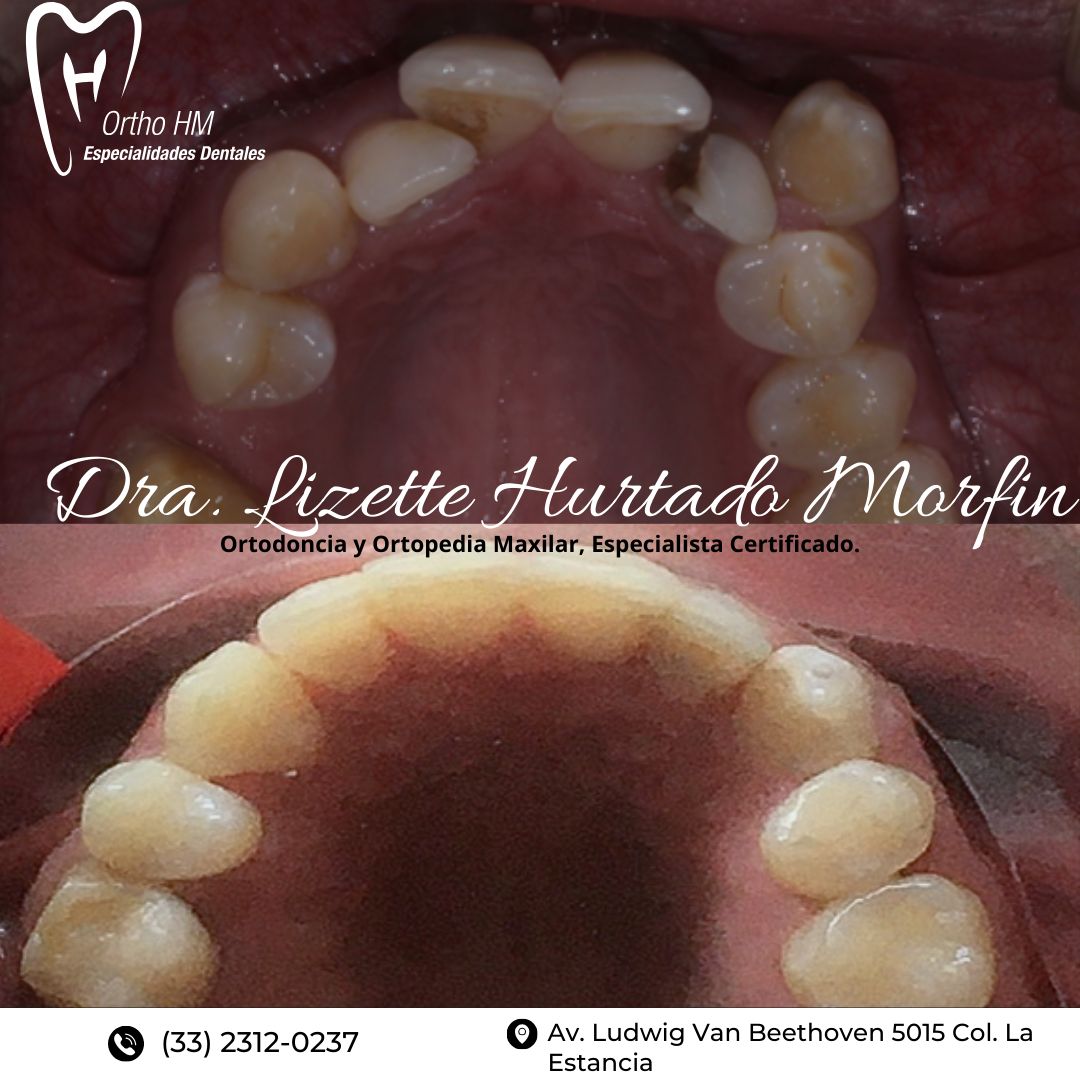 Lizette S. Hurtado Morfin-10