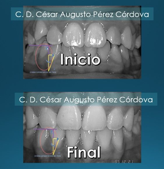 César Augusto Pérez Córdova-27