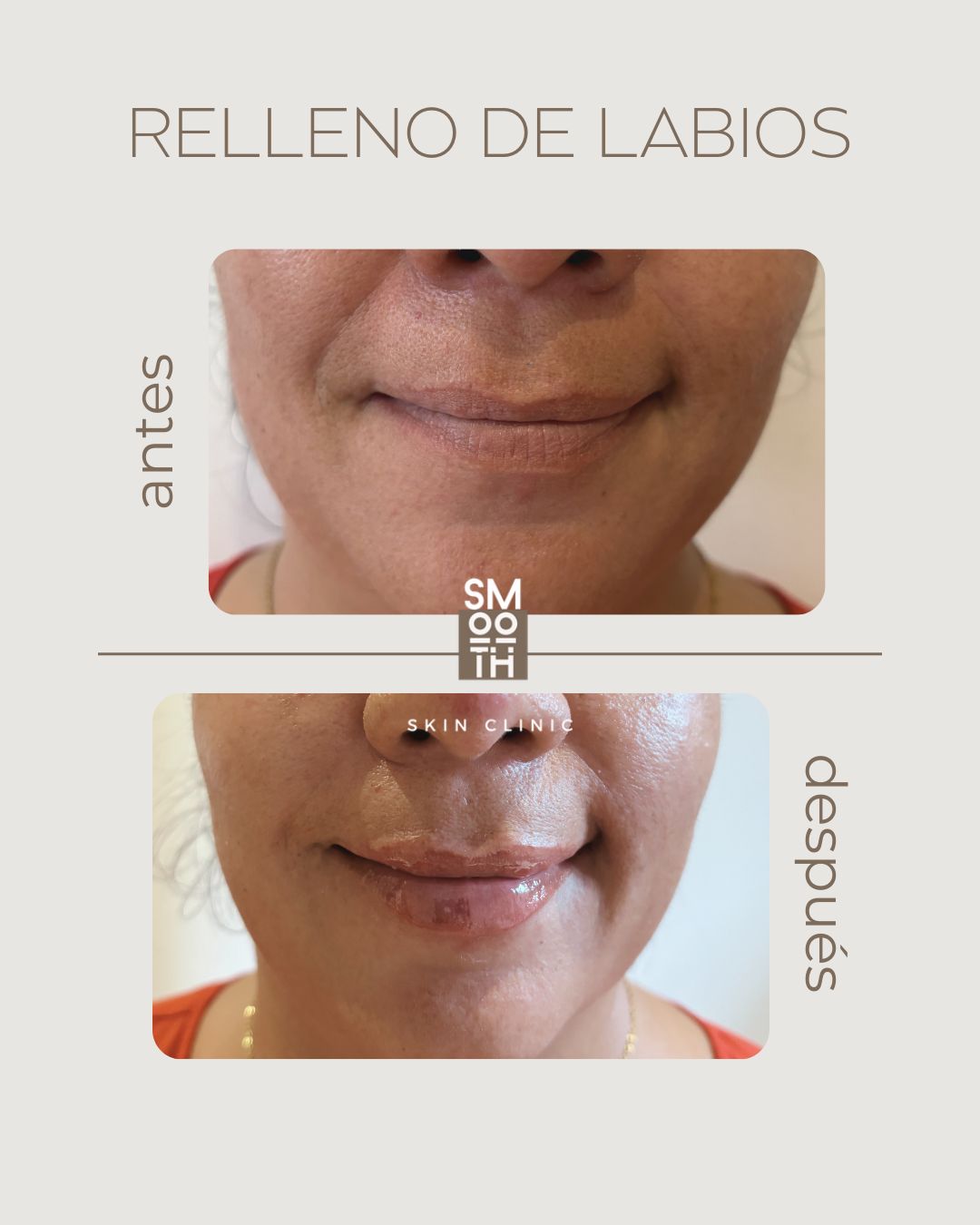 Samantha Martínez-81