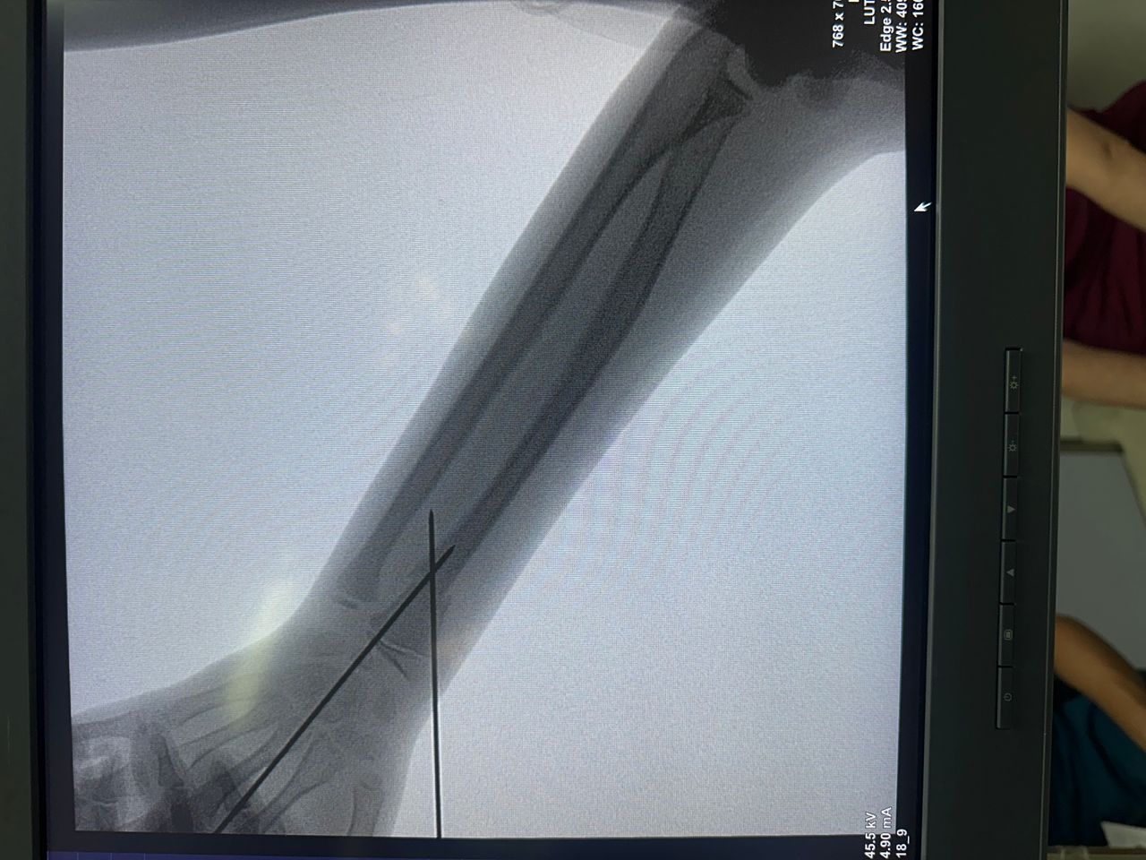 Emmanuel Benitez Biebrich-1