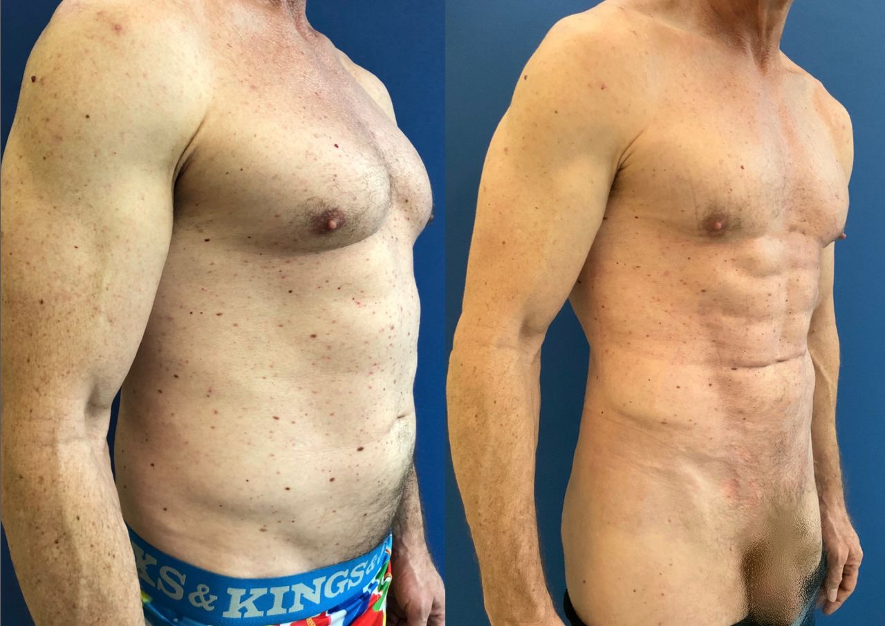 Giuseppe Tanzillo-38