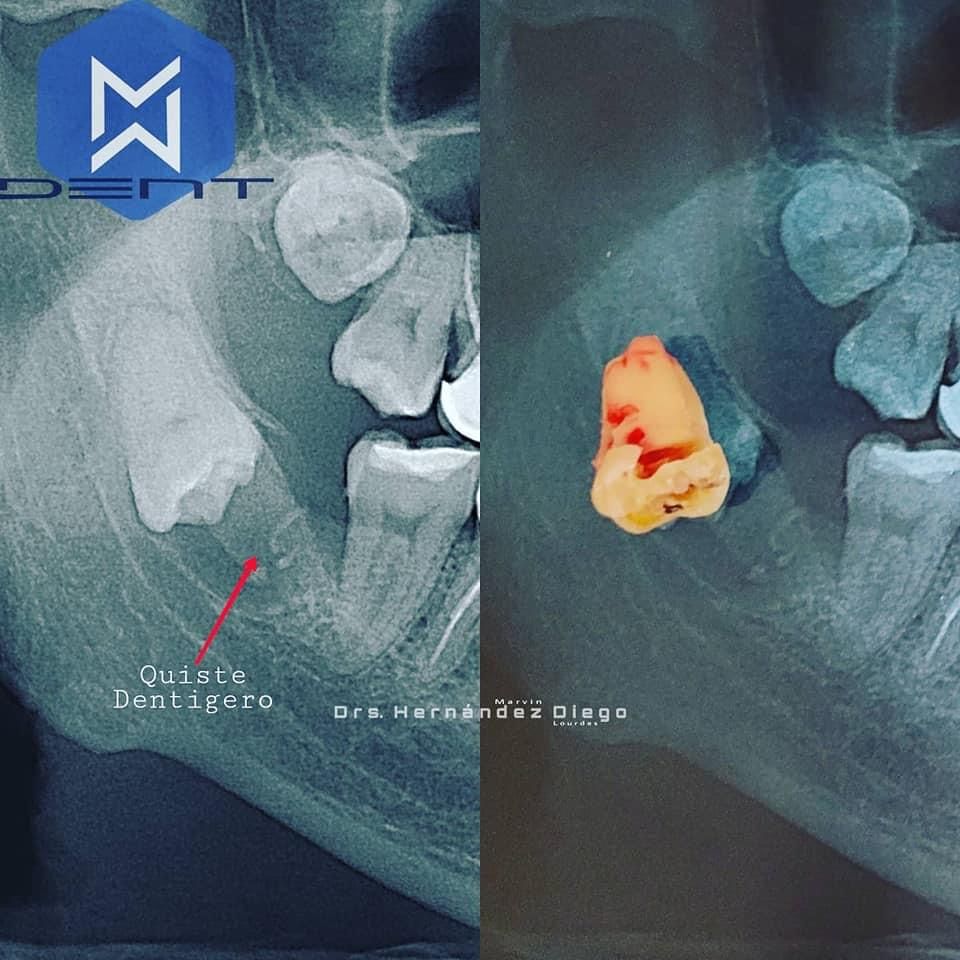 Marvin Adair Hernández Álvarez-42