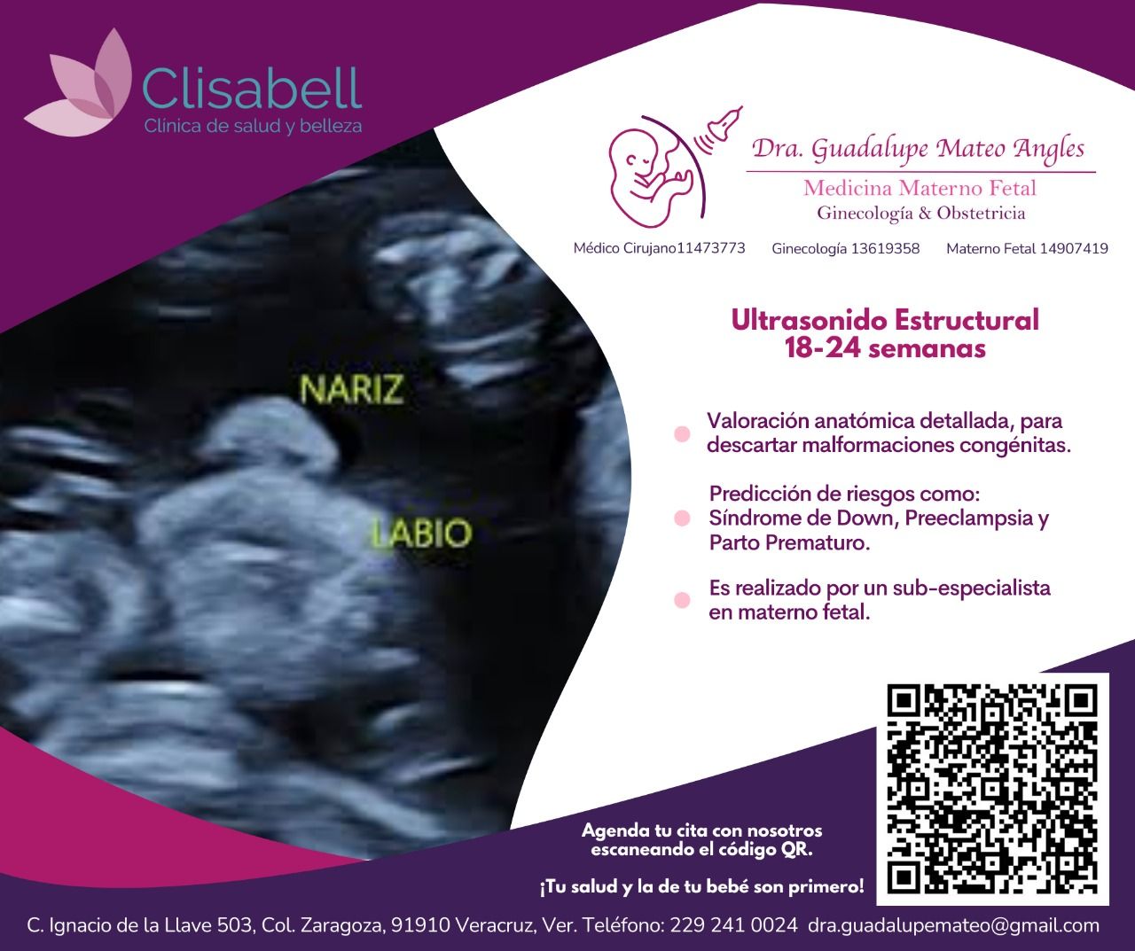 Guadalupe Mateo Angles-3