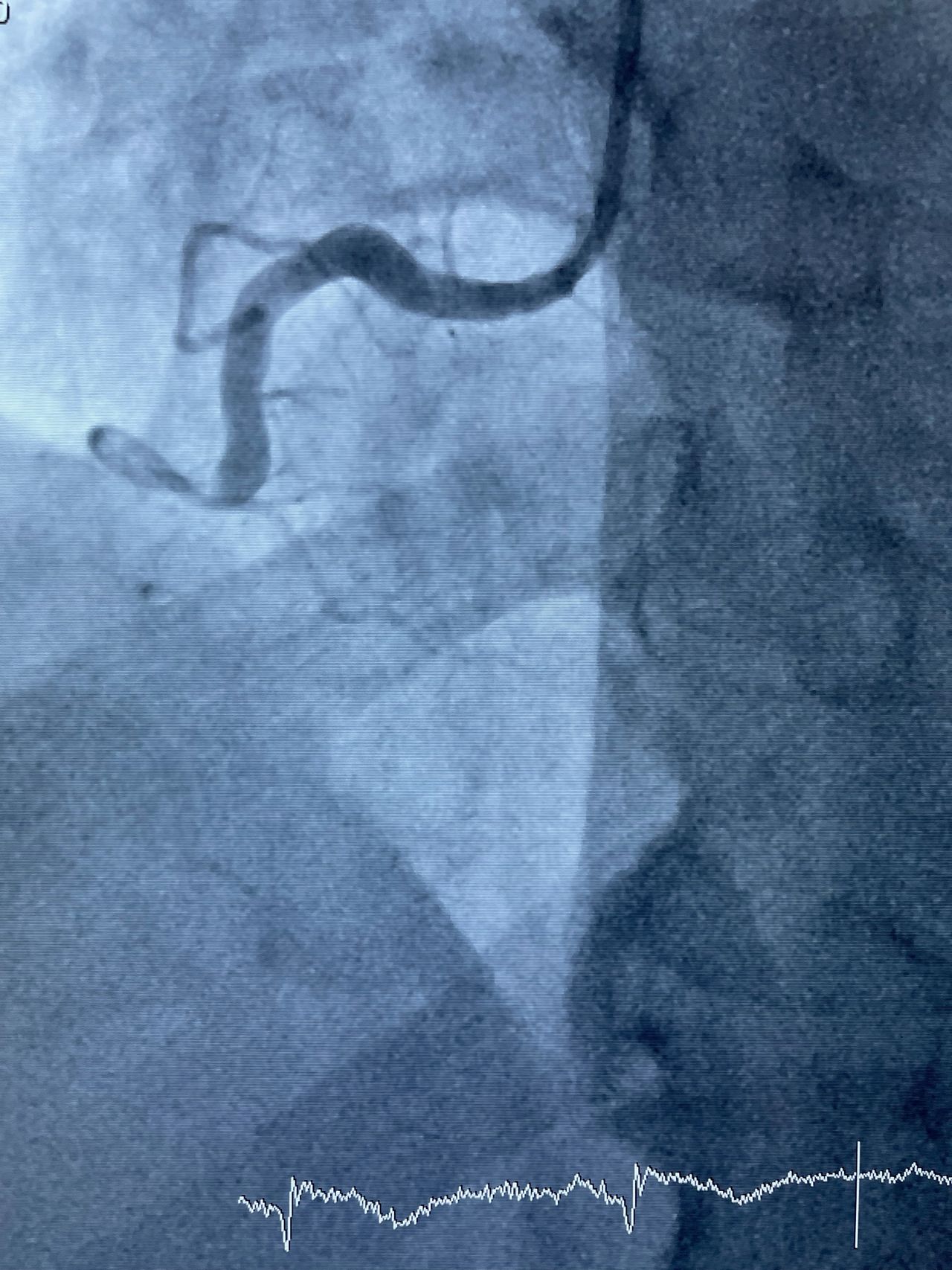 Juan Carlos Esquinca Vera-2