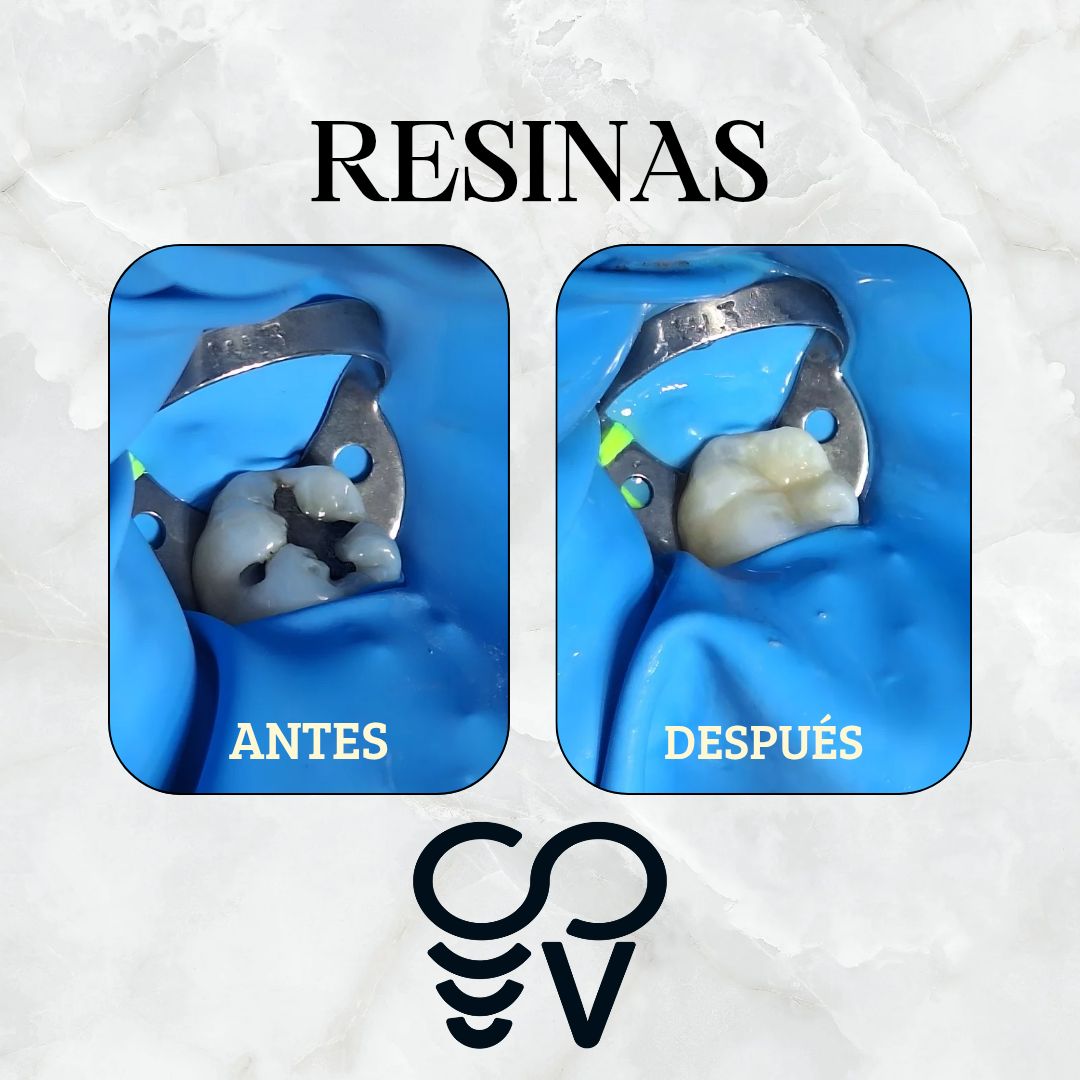 Vianey Sanchez Castro-2