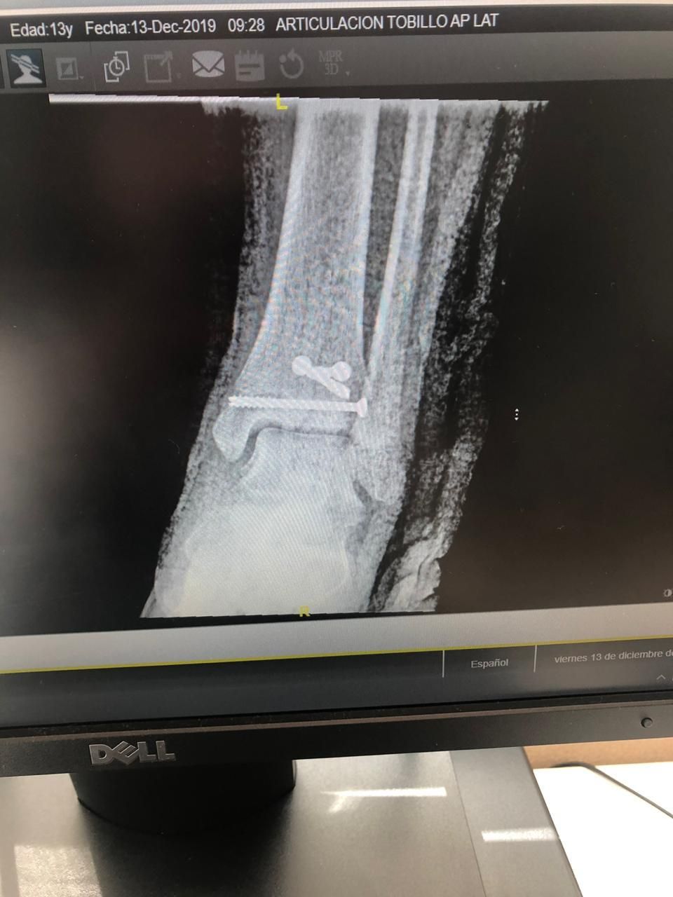 Victor Manuel Alayon Vazquez-3