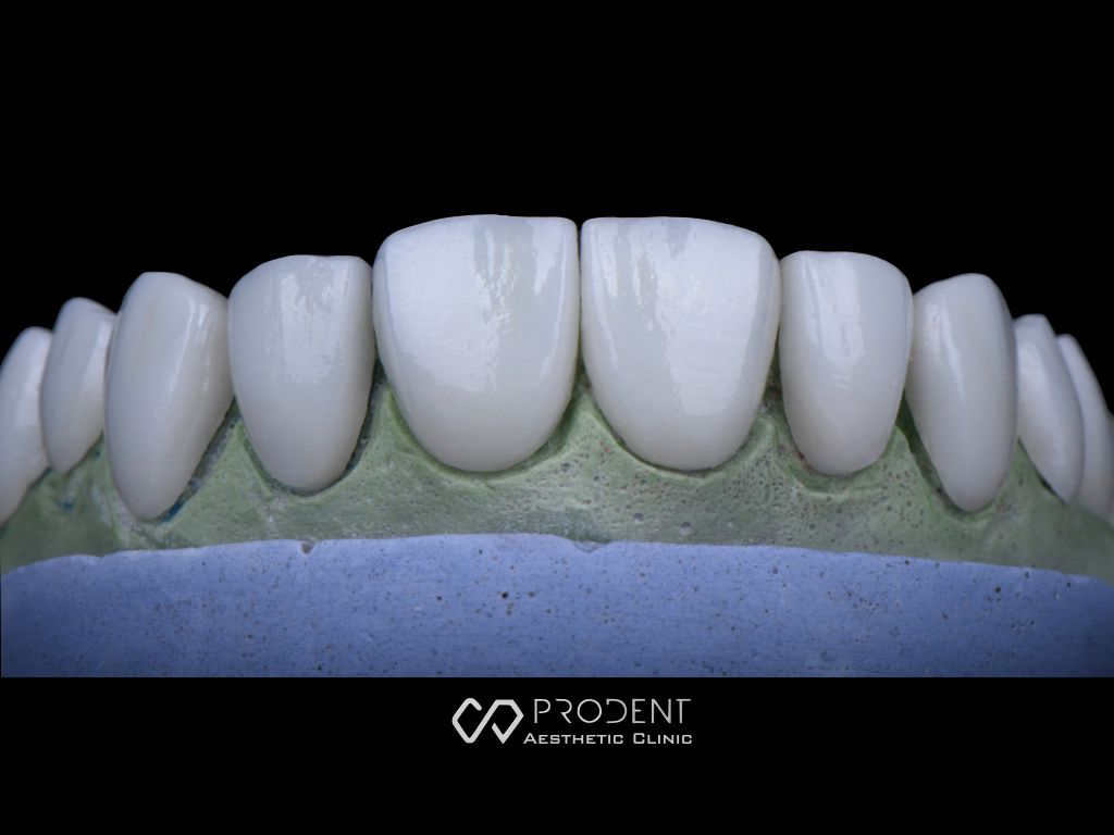 Ramiro Ivan Pérez Murillo-40