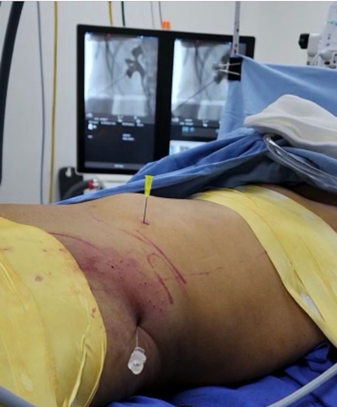 Mario Castillo Archila-6