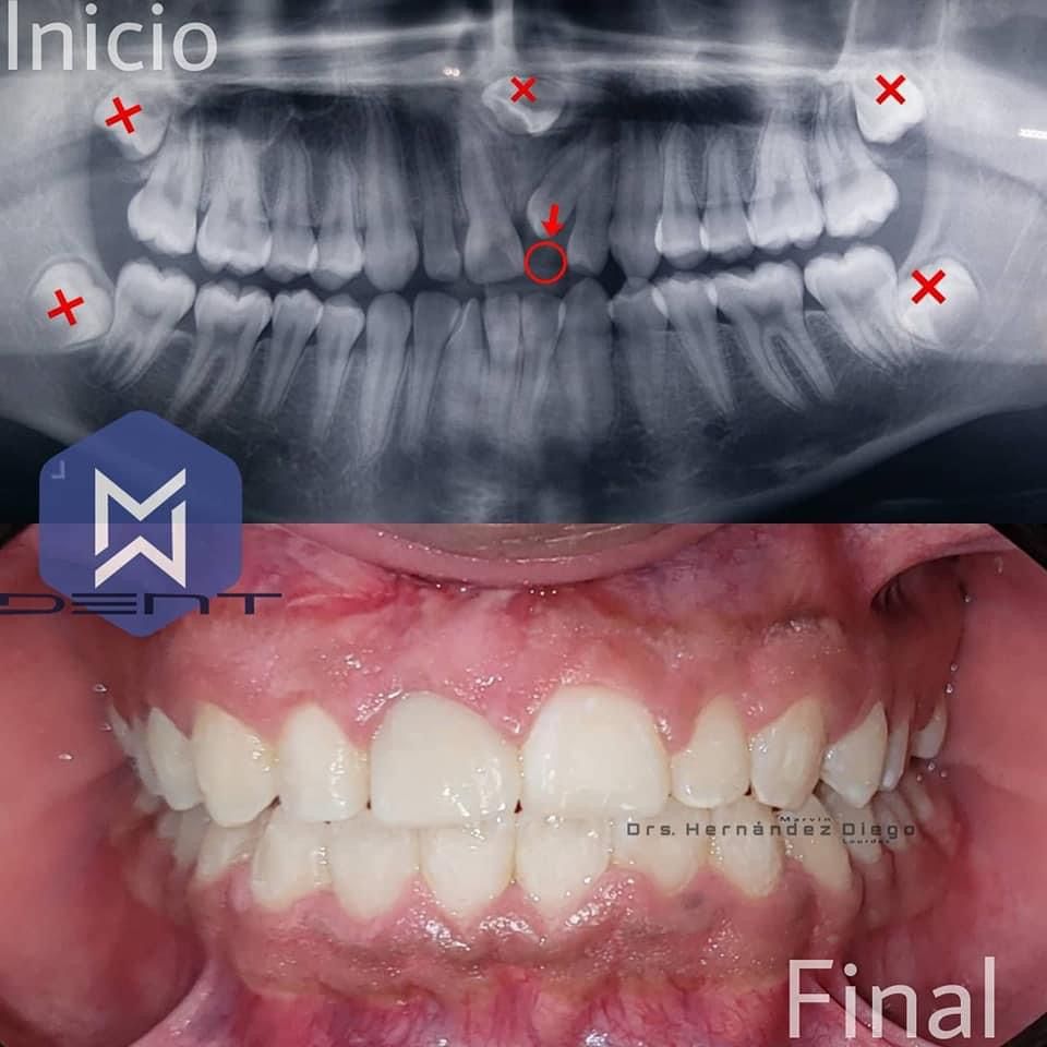 Marvin Adair Hernández Álvarez-52