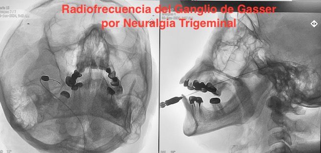 Jesus Rocha Maguey-1