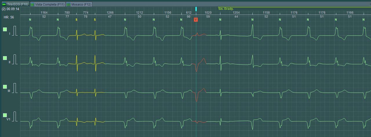 Bernardo Ramírez Martínez-10