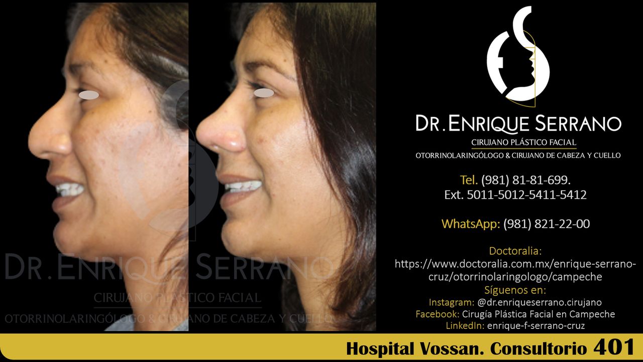 Enrique Serrano Cruz-87